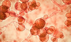 Fungal Infections - Specimen Collection, Transport and Processing